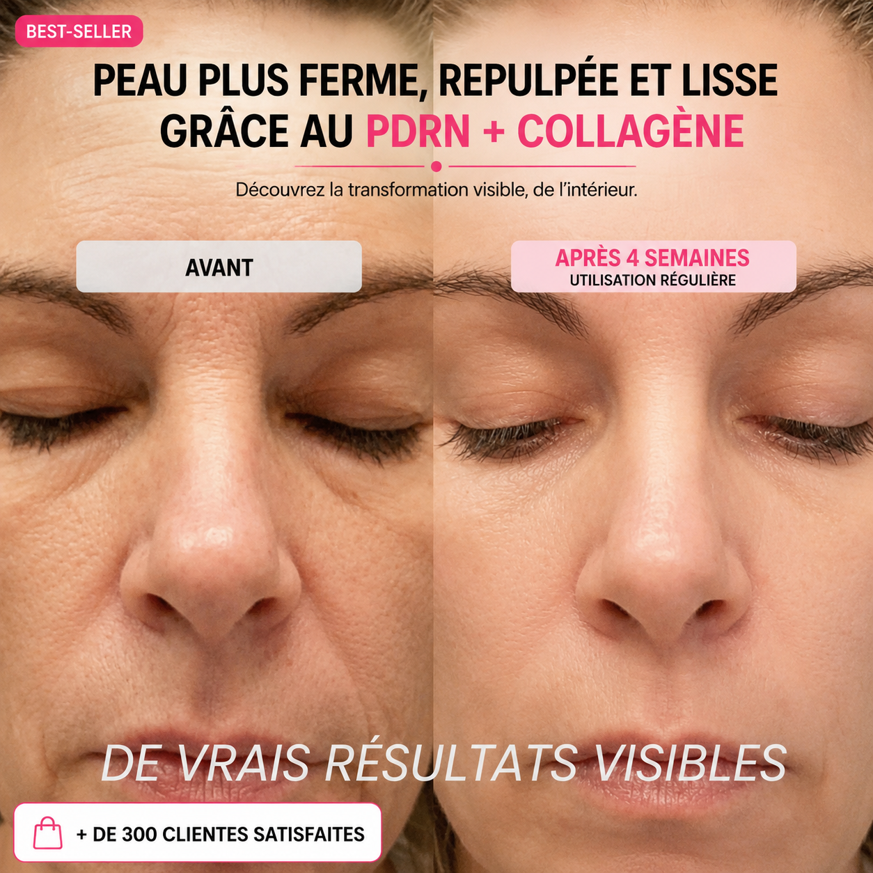 PDRN "stick Collagène"